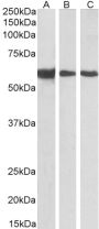 Anti-Desmin antibody (C-Term) (STJ71803)