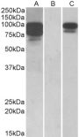 Anti-PCSK9 antibody (214-228) (STJ71819)
