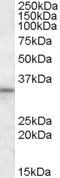 Anti-HAX1 antibody (Internal) (STJ71829)