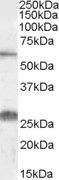 Anti-SLC47A1 antibody (Internal) (STJ71842)