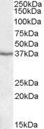 Anti-PON1/paraoxonase 1 antibody (Internal) (STJ71887)