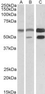 Anti-CAMK2A antibody (Internal) (STJ71922)