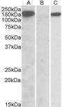 Anti-NALP2/PAN1 antibody (C-Term) (STJ72171)