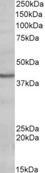 Anti-POU4F3 antibody (Internal) (STJ72237)