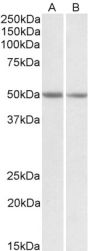Anti-GNAS antibody (Internal) (STJ72252)