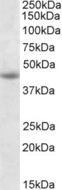 Anti-GNAS antibody (Internal) (STJ72252)