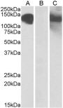 Anti-CDH11 antibody (26-37) (STJ72255)