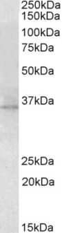 Anti-RDH5 antibody (19-31) (STJ72259)