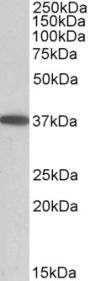 Anti-MOGAT2 antibody (Internal) (STJ72346)