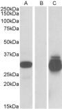 Anti-PPPDE1/PNAS4 antibody (Internal) (STJ72355)