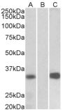 Anti-KCNIP3 antibody (Internal) (STJ72428)