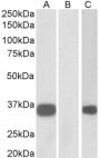 Anti-KCNIP3 antibody (N-Term) (STJ72429)