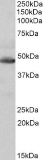 Anti-IDH2 antibody (Internal) (STJ72431)