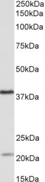 Anti-KLHDC8B antibody (Internal) (STJ72434)