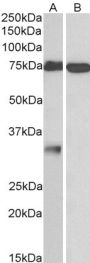 Anti-GPM6A antibody (Internal) (STJ72438)