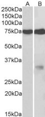 Anti-GPM6A antibody (Internal) (STJ72438)
