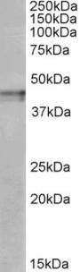Anti-OPRK1 antibody (C-Term) (STJ72447)
