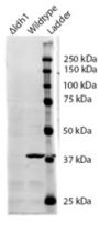 Anti-IDH1 antibody (Internal) (STJ72475)
