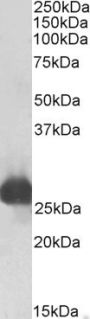 Anti-Gsta3-Rat antibody (Internal) (STJ72498)
