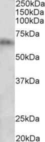 Anti-Cyp2d5/Cyp2d10-Rat antibody (Internal) (STJ72510)