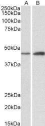 Anti-NDRG2 antibody (N-Term) (STJ72526)