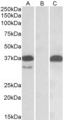 Anti-PIM2 antibody (C-Term) (STJ72541)