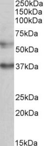 Anti-CBARA1 antibody (113-126) (STJ72551)
