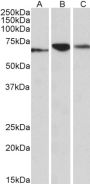 Anti-PDIA2 antibody (477-481) (STJ72559)