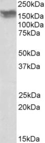 Anti-CD56/NCAM1-Isoform 2 antibody (Internal) (STJ72587)