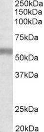 Anti-NPR3 antibody (520-533) (STJ72690)