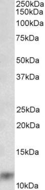 Anti-S100A8 antibody (Internal) (STJ72798)