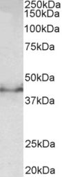 Anti-Doublecortin-Mouse antibody (Internal) (STJ72841)