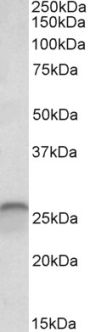 Anti-calbindin D28 antibody (Internal) (STJ72890)
