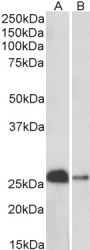 Anti-calbindin D28 antibody (Internal) (STJ72890)