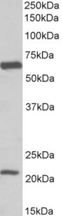 Anti-EAAT1/GLAST1 antibody (197-208) (STJ72934)