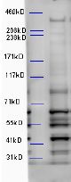 Anti-Alfy/WDFY3 antibody (Internal) (STJ73103)