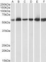 Anti-HSP60/HSPD1 antibody (333-344) (STJ73246)