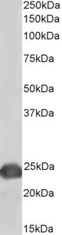 Anti-PARK7/DJ-1, biotinylated antibody (C-Term) {Biotin} (STJ73276)