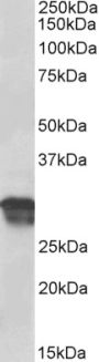 Anti-cyclin D1 antibody (Internal) (STJ73356)