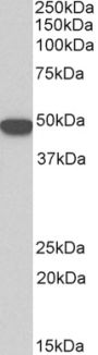 Anti-keratin 18 antibody (Internal) (STJ73363)