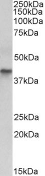 Anti-cytokeratin 19 antibody (285-298) (STJ73365)