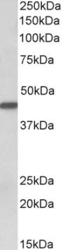 Anti-cytokeratin 19 antibody (C-Term) (STJ73366)