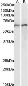 Anti-calreticulin antibody (Internal) (STJ73377)