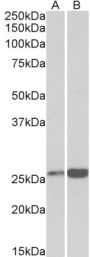 Anti-peroxiredoxin 6 antibody (170-180) (STJ73395)