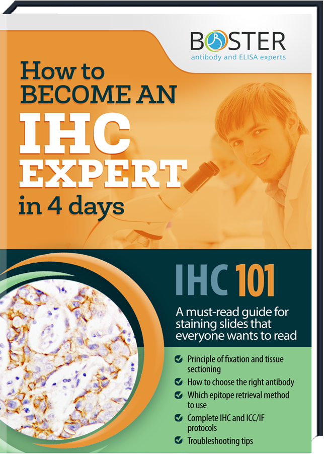 Get your free Handbook about the IHC-Tecnique