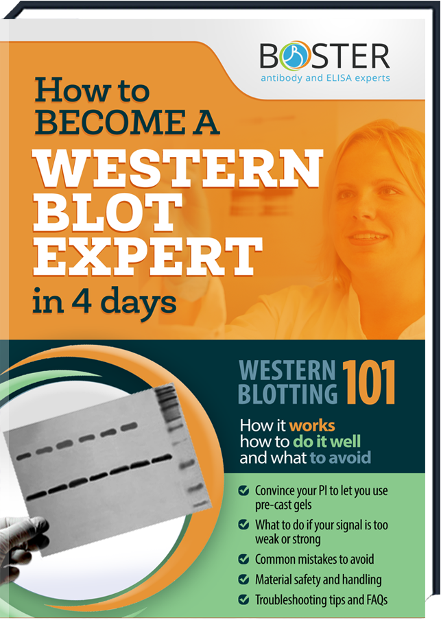 Erhalten dein kostenloses Handbuch über die Western Blot-Methode
