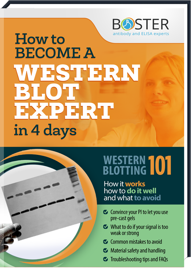 Cover of the Western Blot-Handbook